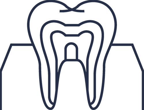davidsdental.com - Curățarea canalelor dentare