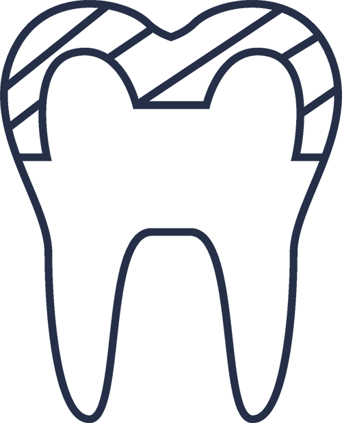 davidsdental.com - Fațete dentare