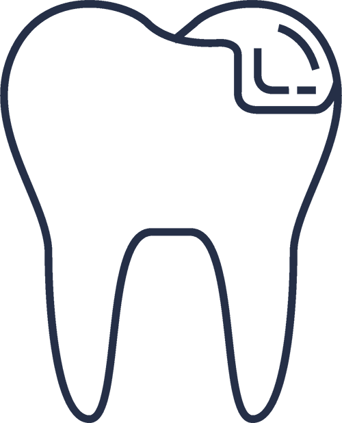 davidsdental.com - Obturatii dentare